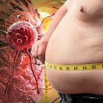Obesidade e prognóstico de cancro: o risco e a influência