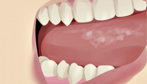 autoexame cavidade oral