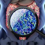 Imunoterapia: influência dos probióticos e da alimentação na eficácia