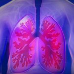 Cancro do pulmão: reduza o seu risco