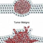 Diferenças entre tumores benignos e malignos