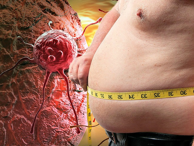 obesidade e prognostico de cancro